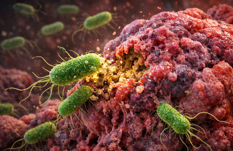 Ein Bakterium namens Clostridium sporogenes soll in der Lage sein, Tumore zu fressen. (Symbolbild)